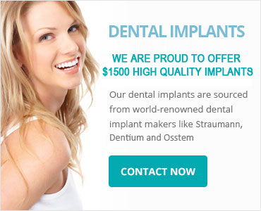 Tooth Implant Sydney