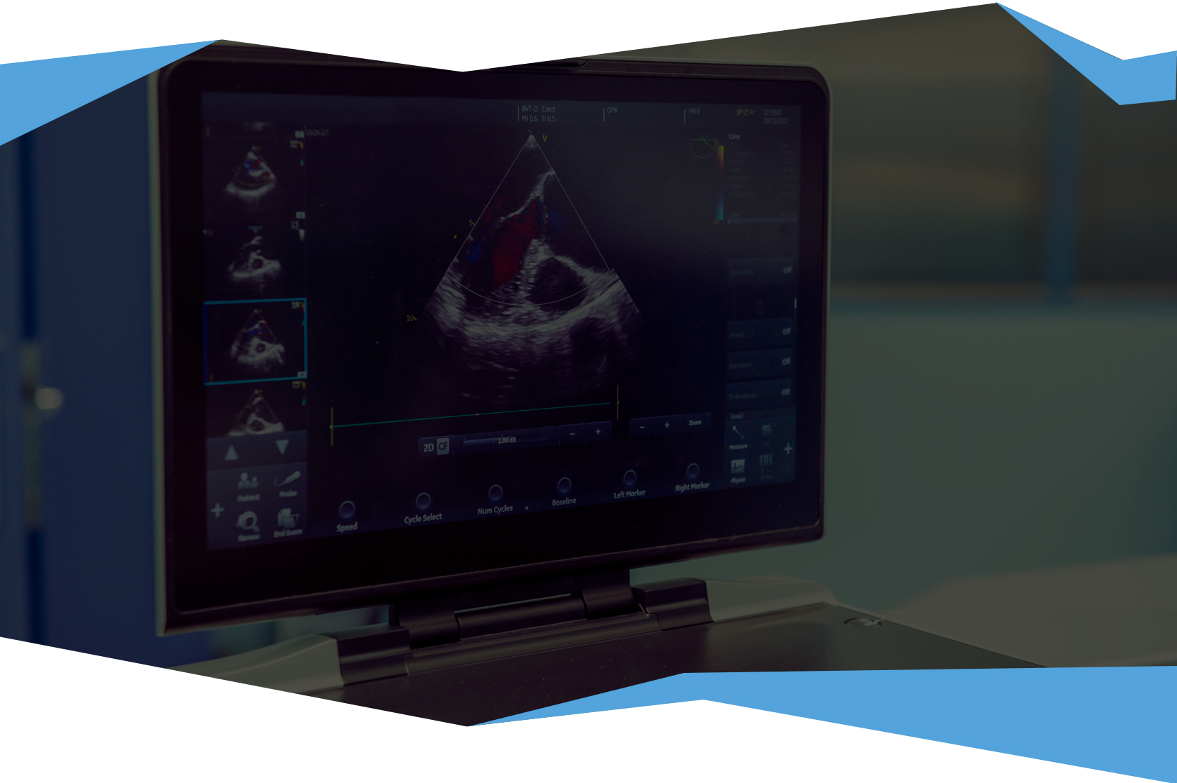 Ultra Select Medical